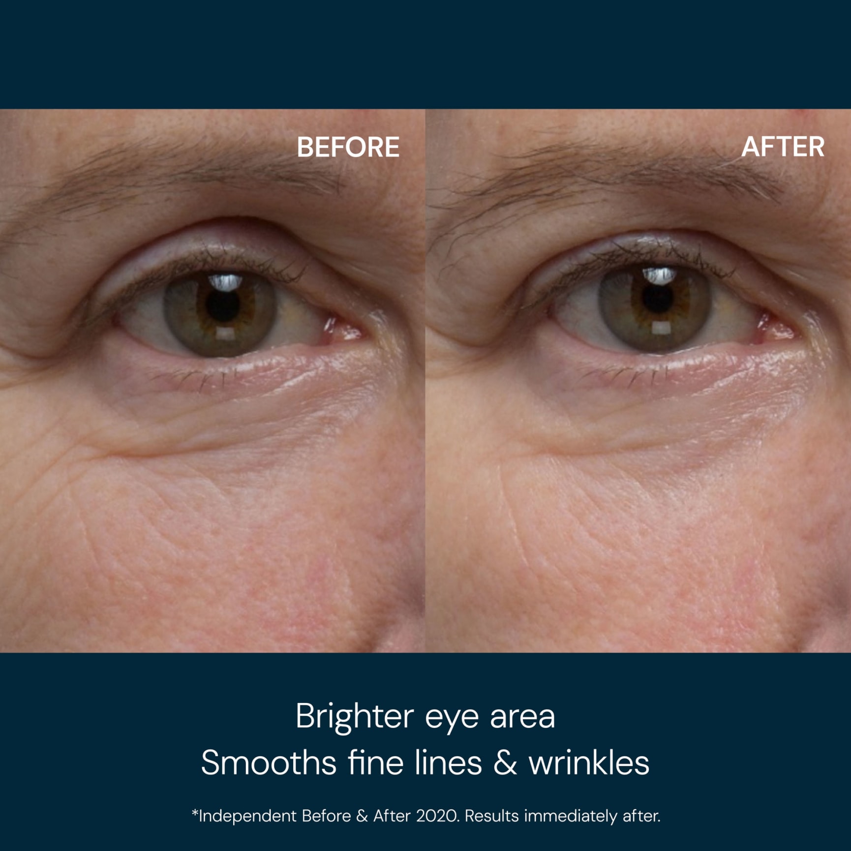 Pro-CollagenEyeReviveMask_BeforeAfter