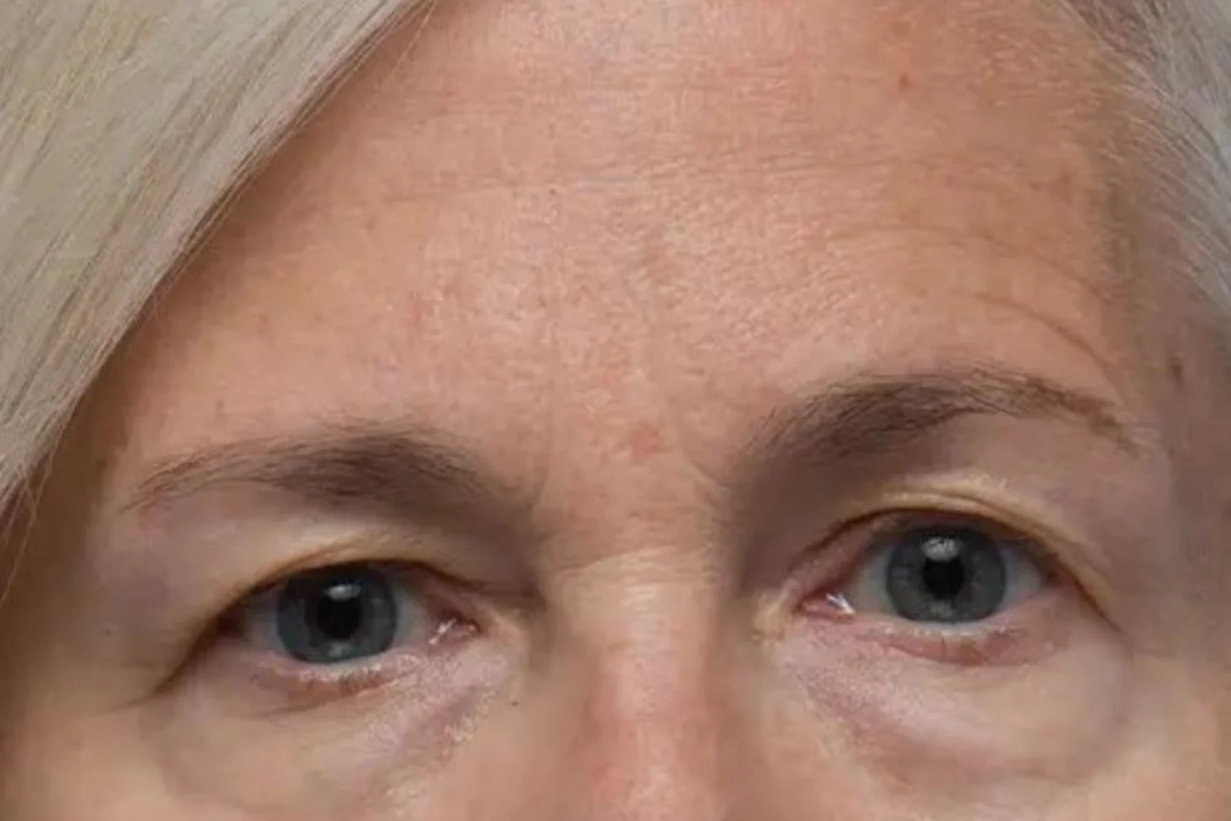 What Is Mature Skin?