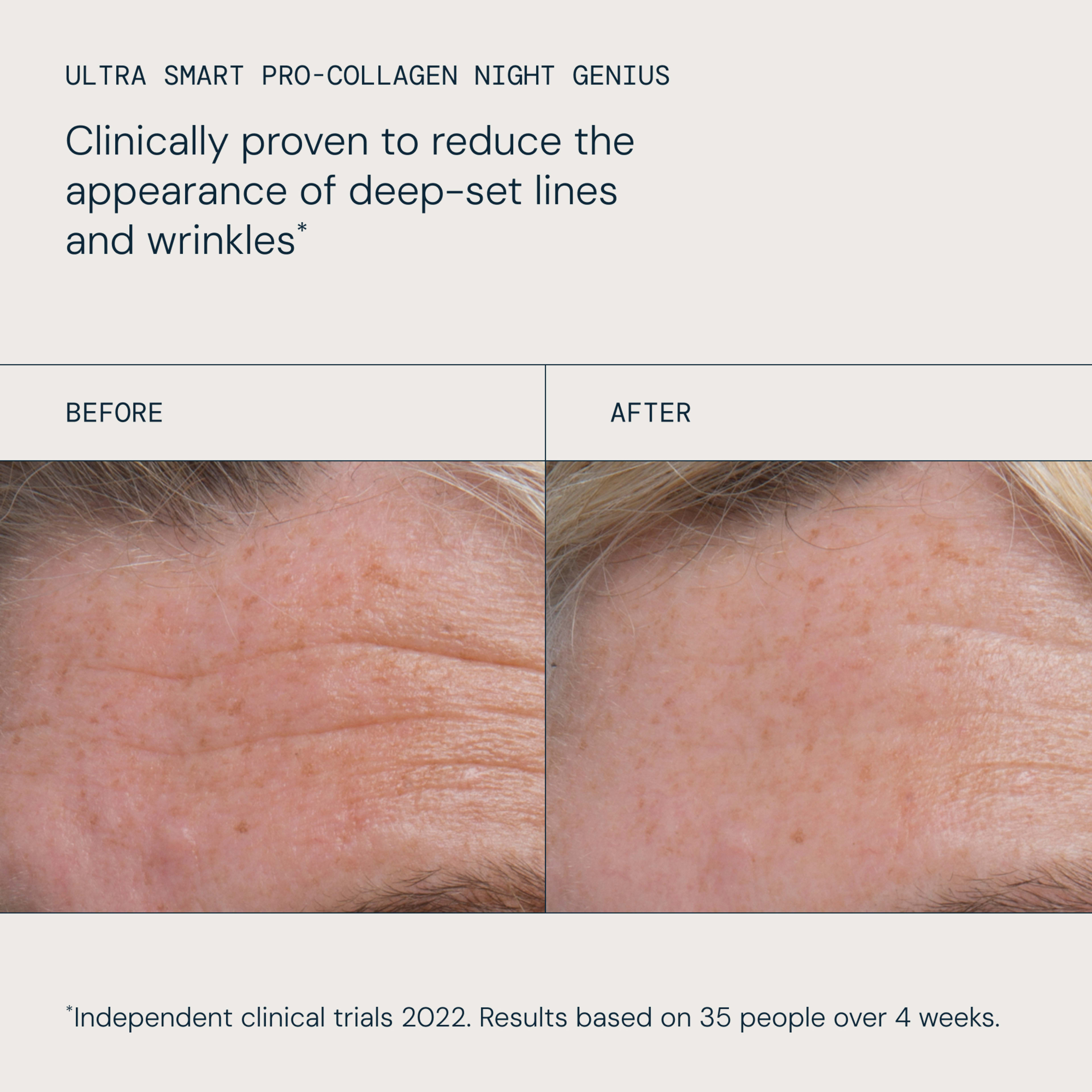 ELEMIS Ultra Smart Pro-Collagen Night Genius claim: clinically proven to reduce the appearance of deep-set lines and wrinkles, based on independent clinical trials in 2022 with 35 people over 4 weeks. Before-and-after forehead photos show visibly reduced wrinkles.