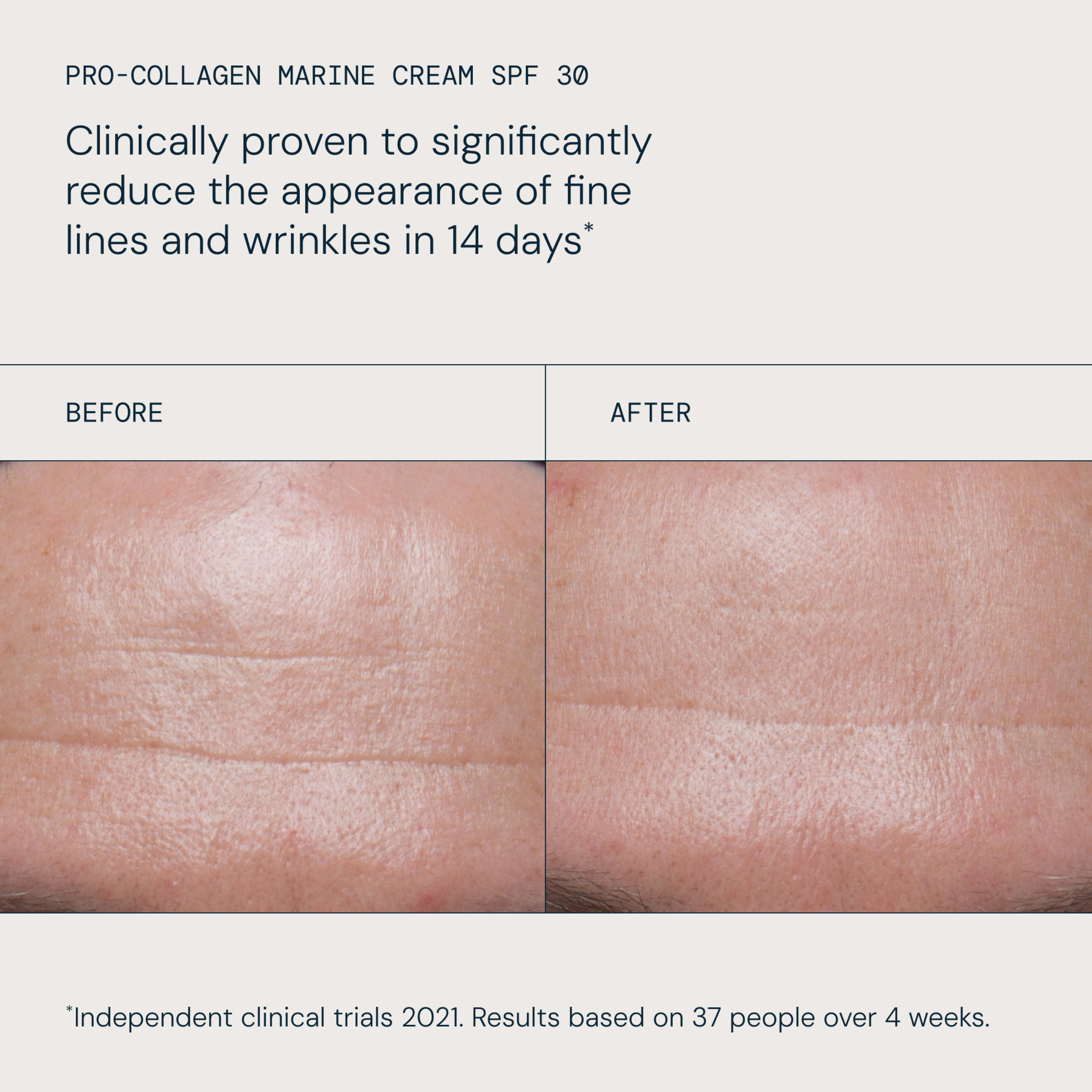 ELEMIS Pro-Collagen Marine Cream SPF 30 claim: “Clinically proven to significantly reduce the appearance of fine lines and wrinkles in 14 days*”.  

Before-and-after close-ups of a forehead showing visibly smoother skin and reduced lines after using the cream; small print notes independent clinical trial on 37 people over 4 weeks.
