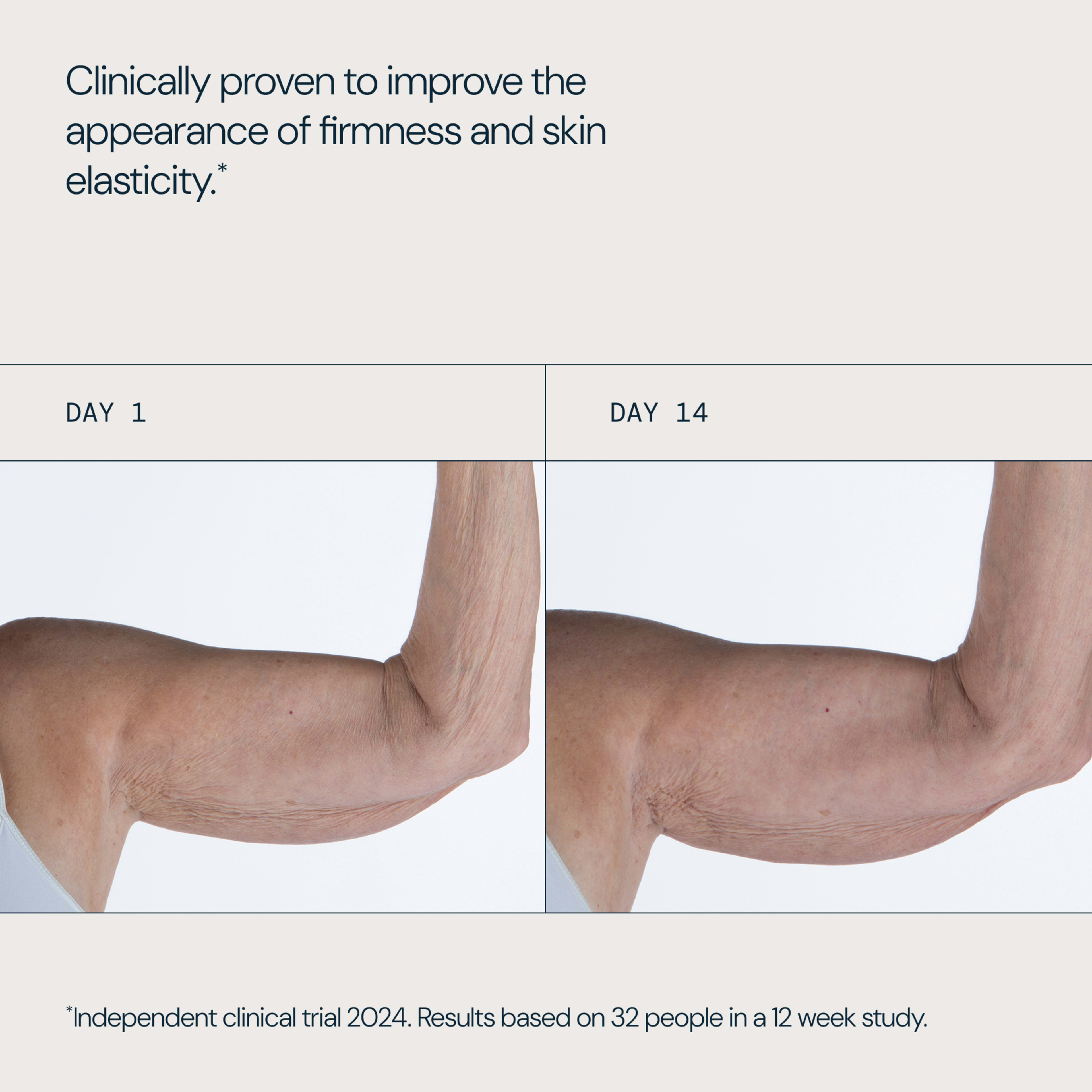 Clinically proven to improve the appearance of firmness and skin elasticity. Side‑by‑side photos show the same person’s upper arm on day 1 and day 14, with visibly smoother, firmer skin. Independent clinical trial 2024, 32 people, 12 week study.