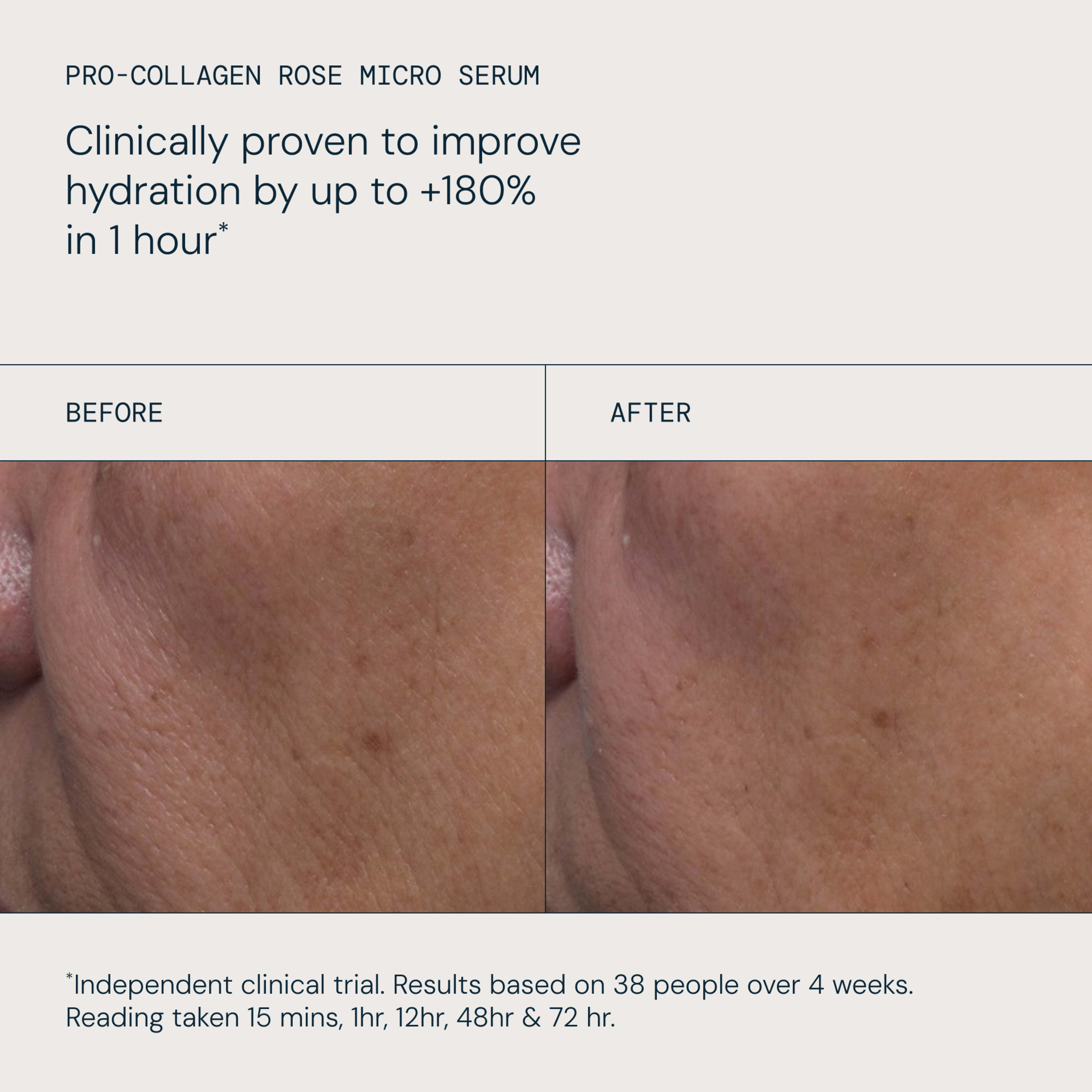 ELEMIS Pro-Collagen Rose Micro Serum claim: “Clinically proven to improve hydration by up to +180% in 1 hour*.” Before-and-after close-ups of facial skin show smoother, more hydrated texture after use. Footnote: independent clinical trial on 38 people over 4 weeks.