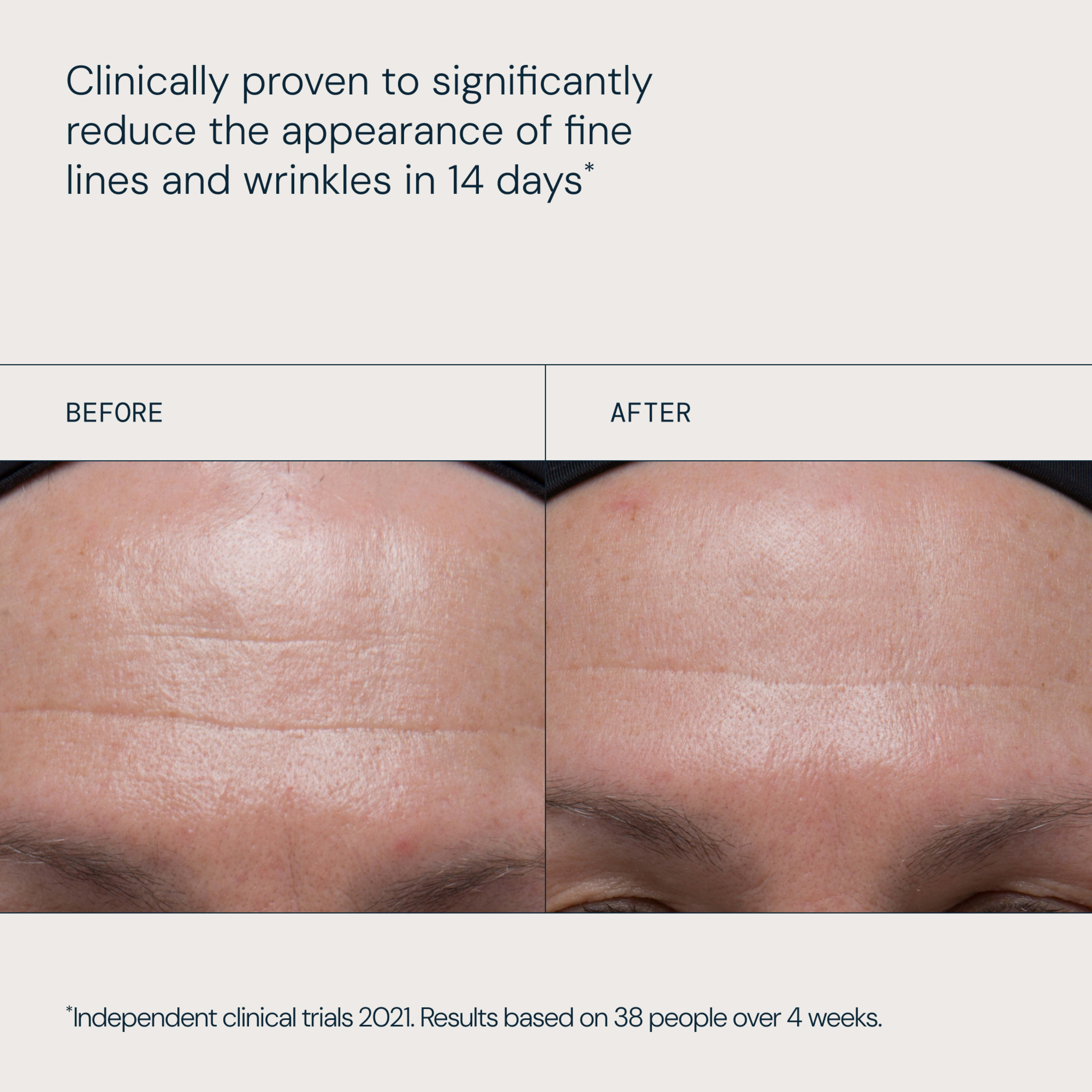 Clinically proven claim: “Clinically proven to significantly reduce the appearance of fine lines and wrinkles in 14 days”, with a before-and-after close-up of a forehead showing fewer visible lines in the after image. Footnote: “Independent clinical trials 2021. Results based on 38 people over 4 weeks.”