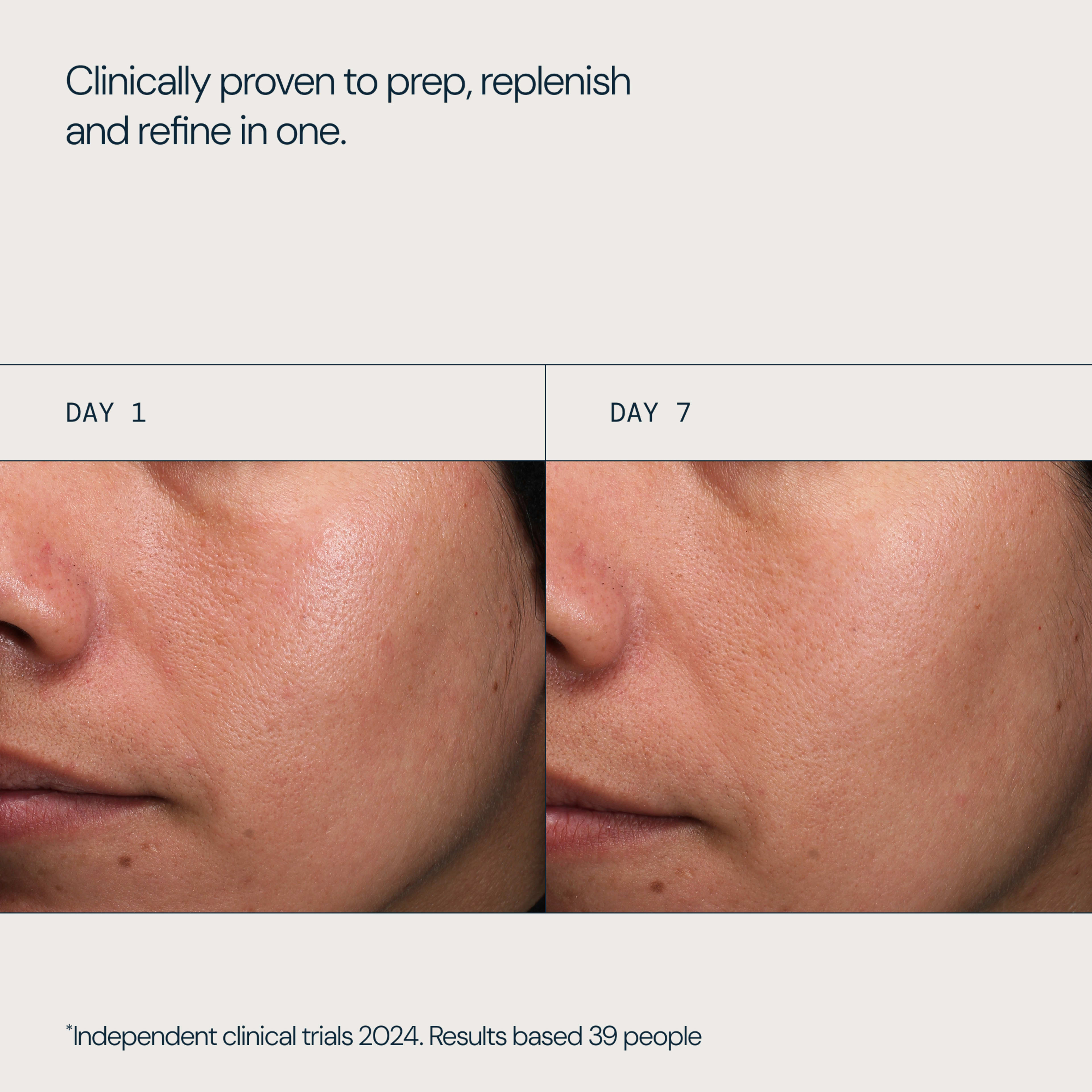 Before-and-after close-ups of a woman’s cheek labelled “Day 1” and “Day 7”, showing smoother, more refined skin texture after use. Text reads “Clinically proven to prep, replenish and refine in one” and “Independent clinical trials 2024. Results based 39 people”.