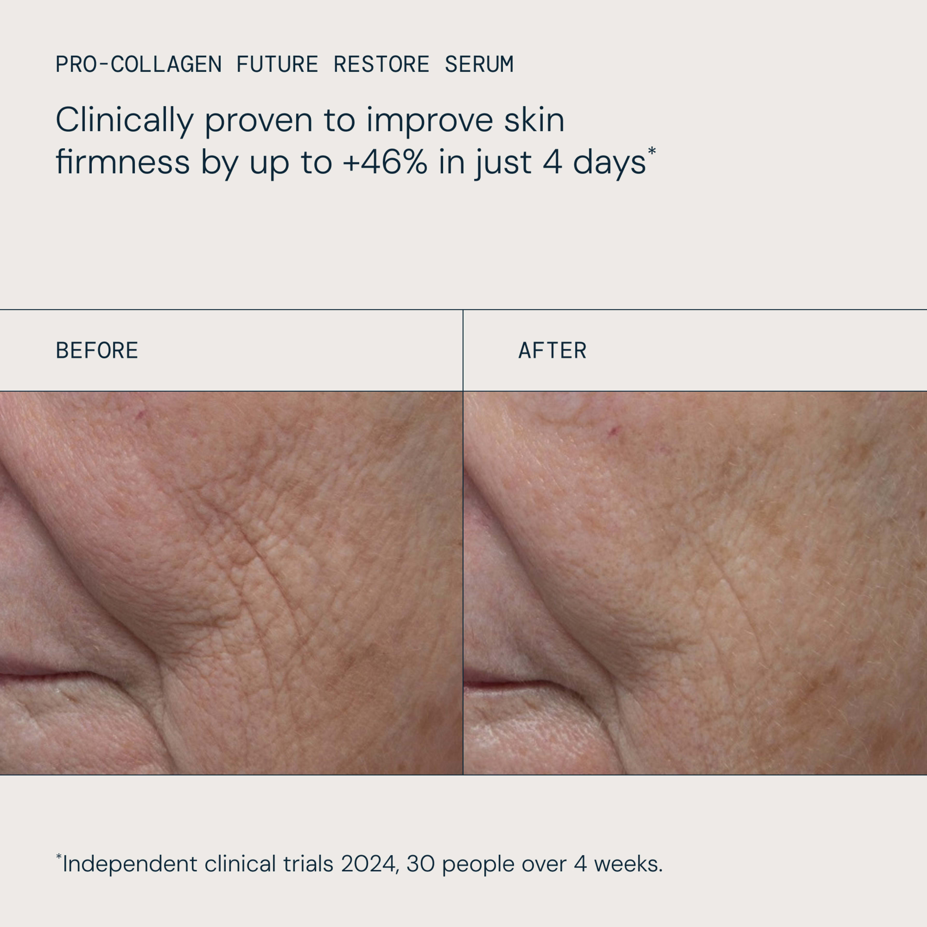 ELEMIS Pro-Collagen Future Restore Serum claim: “Clinically proven to improve skin firmness by up to +46% in just 4 days*”. Before-and-after close-ups show reduced wrinkles and smoother skin on the same facial area. *Independent clinical trials 2024, 30 people over 4 weeks.