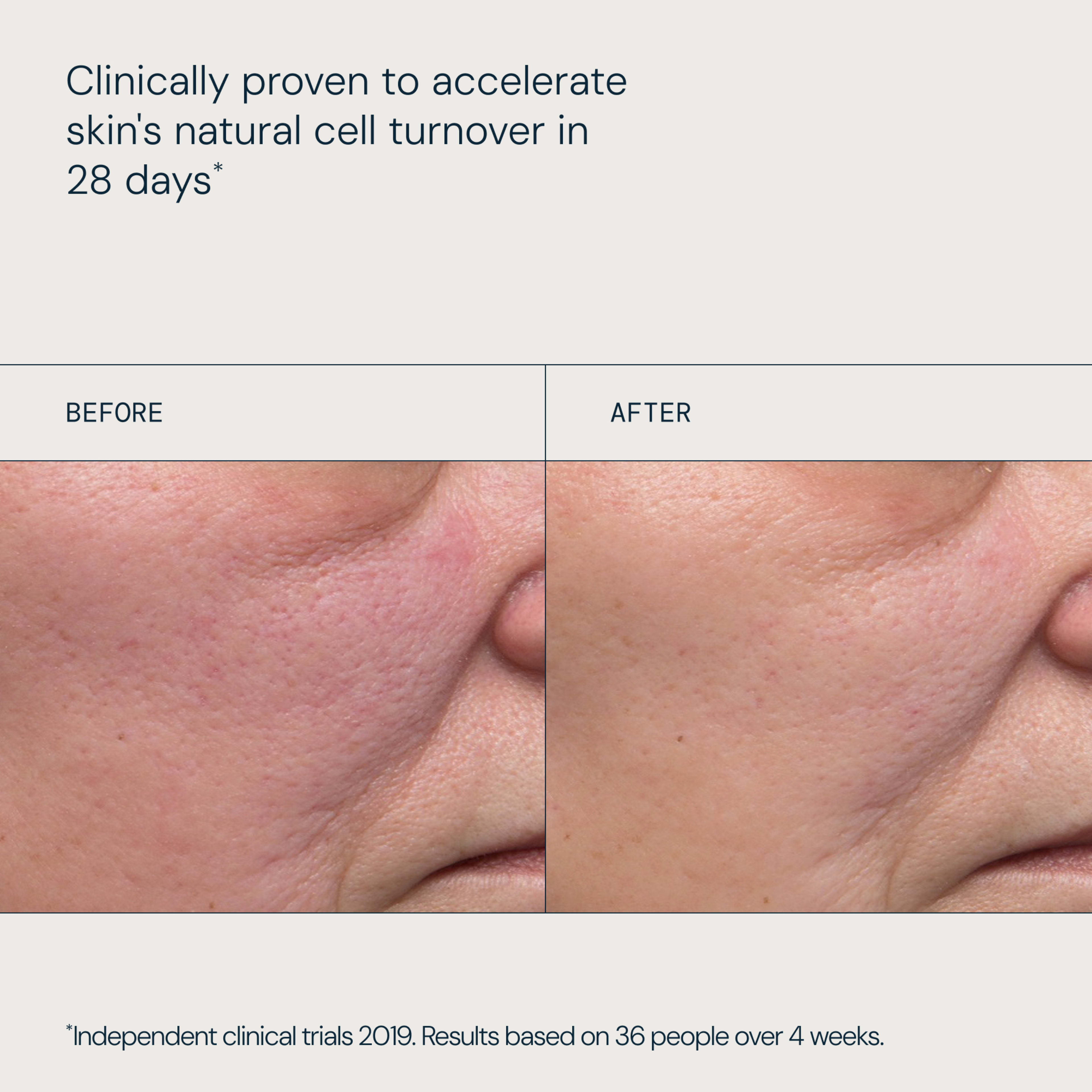 Text written 'clinically proven to accelerate skin’s natural cell turnover in 28 days'. Split-screen close-up of a cheek labelled before and after, showing reduced redness and smoother skin texture after treatment, with small-print note on independent clinical trials.