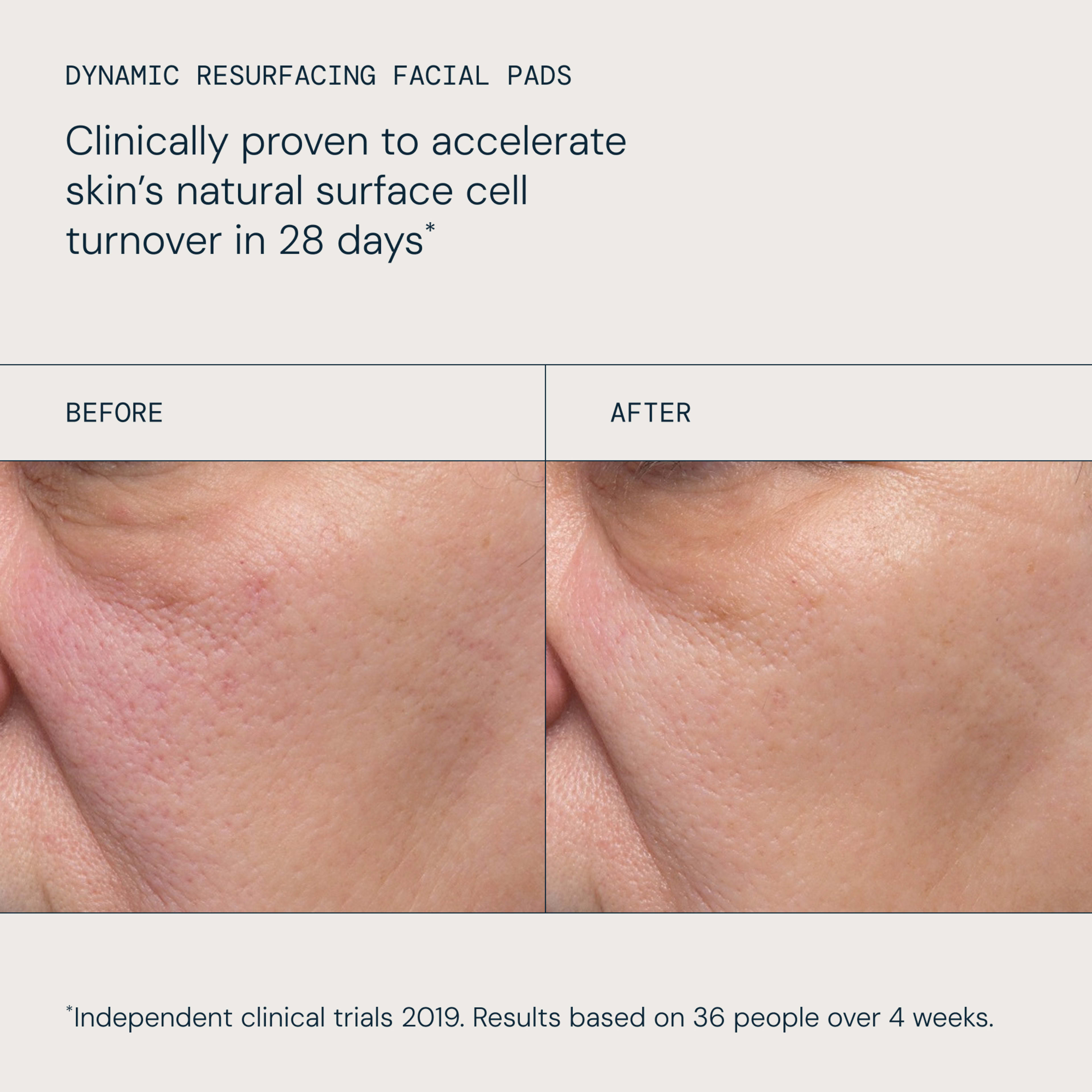 ELEMIS Dynamic Resurfacing Facial Pads claim: clinically proven to accelerate skin’s natural surface cell turnover in 28 days. Split-screen before-and-after close-ups show reduced redness and smoother skin texture after use, based on independent trials of 36 people over 4 weeks.