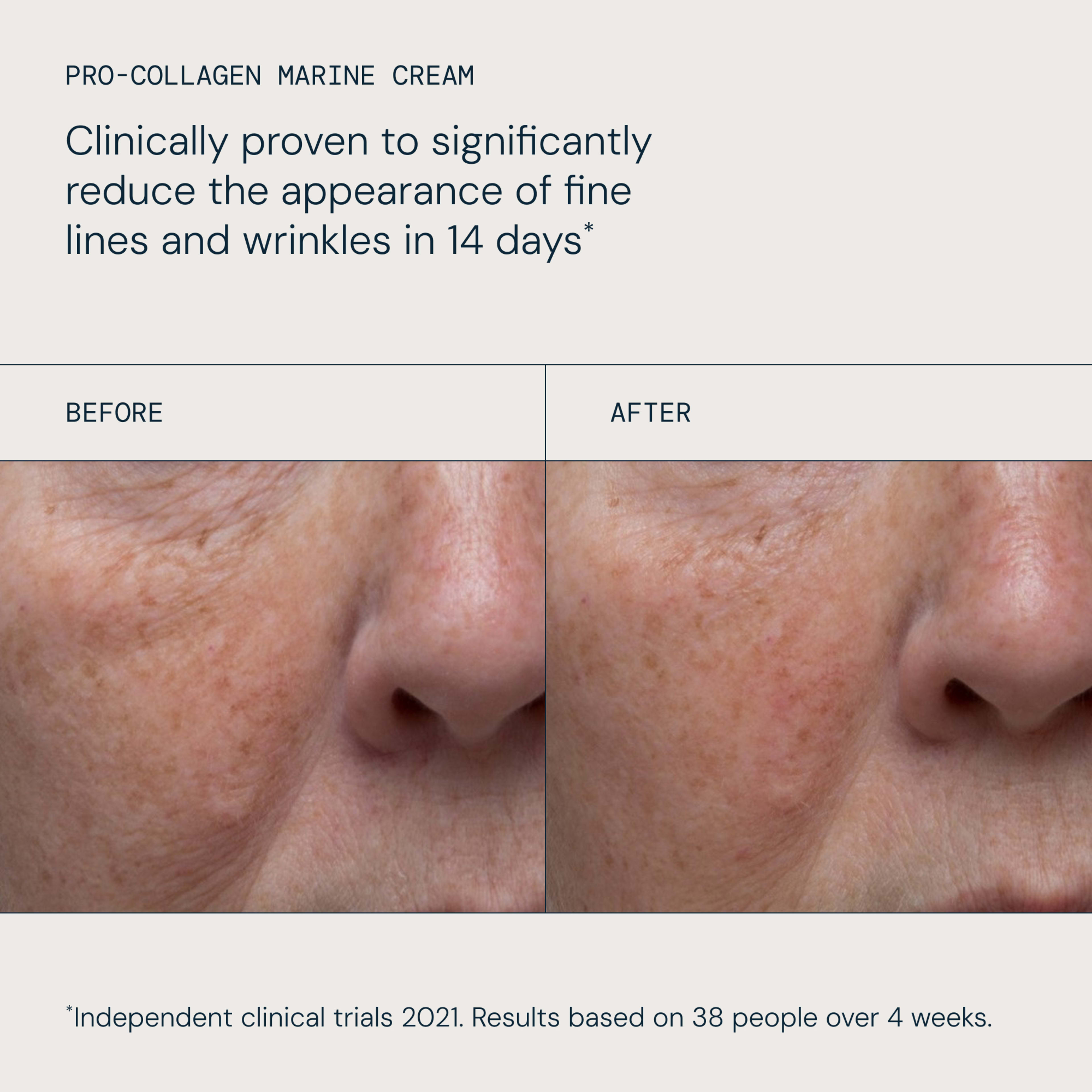 ELEMIS Pro-Collagen Marine Cream claim reading “Clinically proven to significantly reduce the appearance of fine lines and wrinkles in 14 days”, with side-by-side close-ups of a cheek and nose labelled before and after showing visibly smoother skin.
