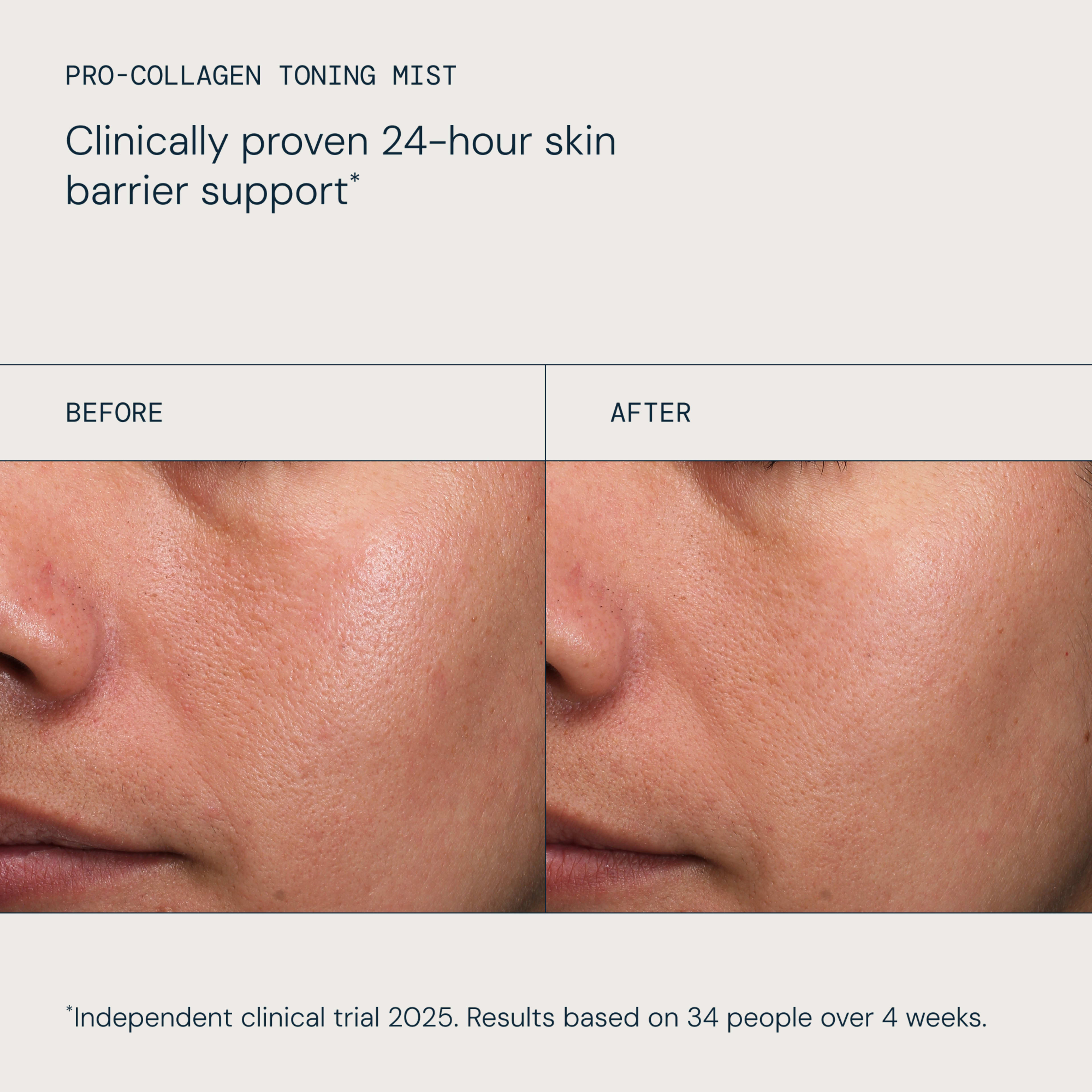 ELEMIS Pro-Collagen Toning Mist clinical claim: “Clinically proven 24-hour skin barrier support*”. Side-by-side close-ups labelled “Before” and “After” show smoother, more even cheek skin after use. Footnote: “Independent clinical trial 2025… over 4 weeks.”