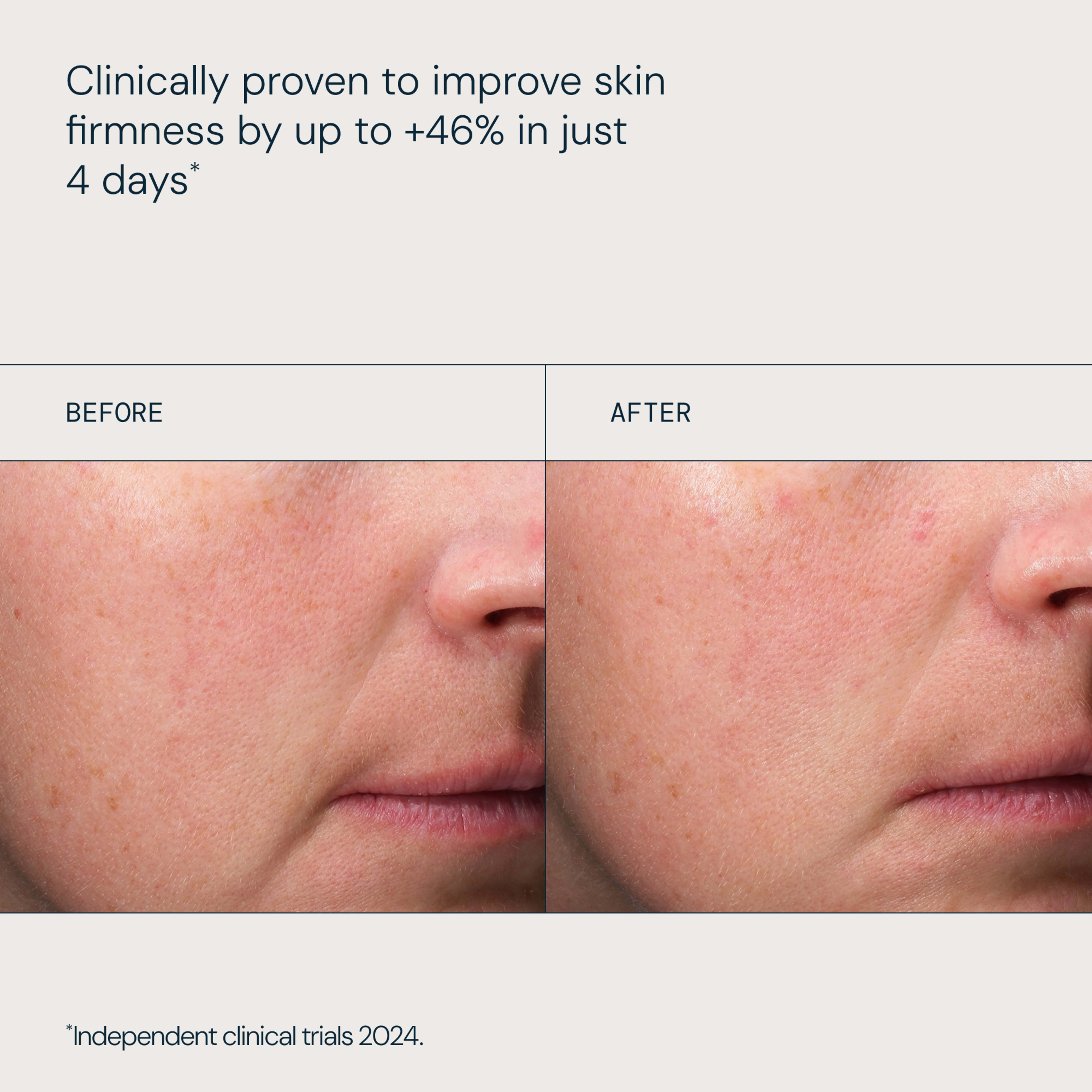 Clinically proven to improve skin firmness by up to +46% in just 4 days, with side‑by‑side close‑ups of a woman’s cheek and jawline labelled “before” and “after” showing smoother, firmer skin in the after image.  

Text at bottom: “Independent clinical trials 2024.”