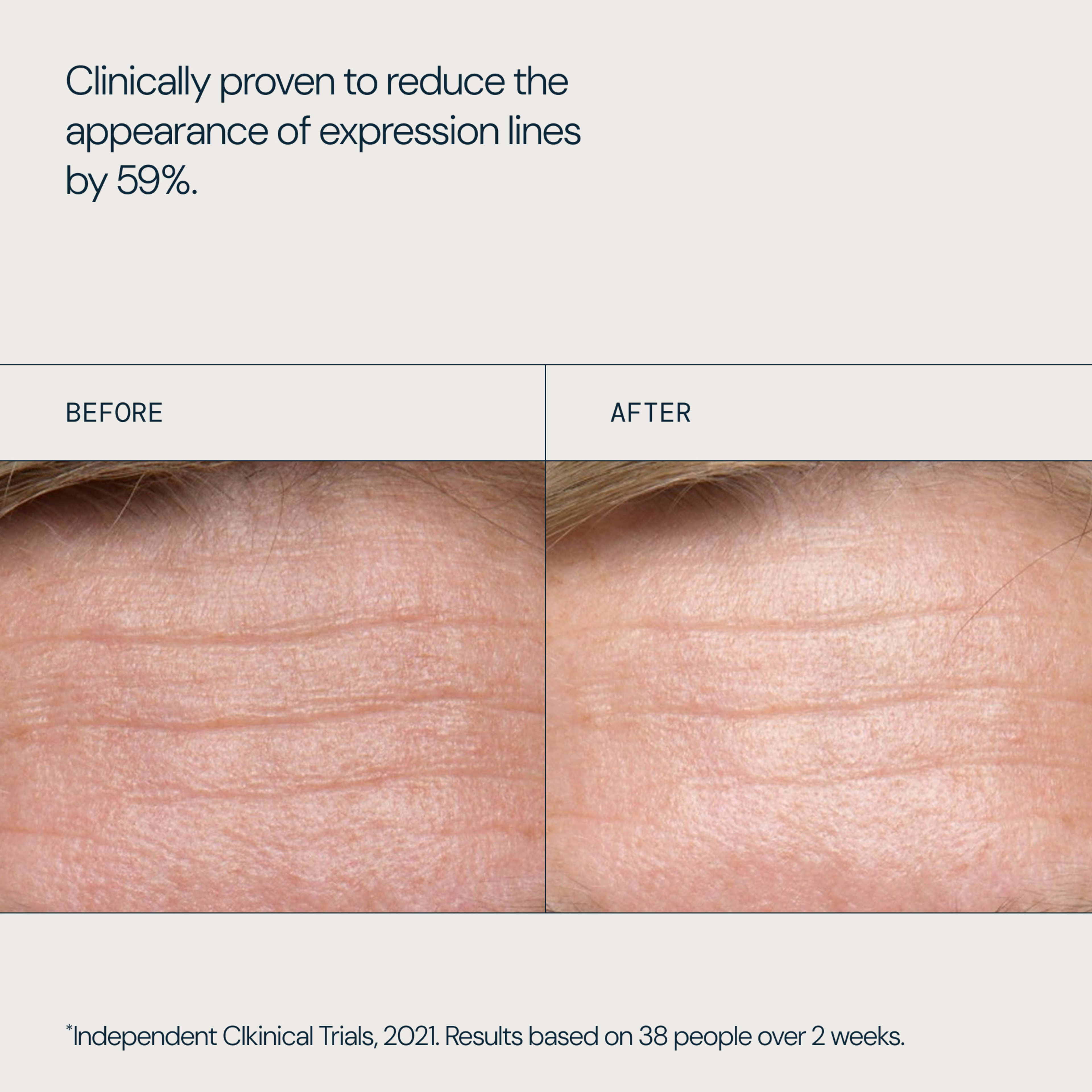 Clinically proven to reduce the appearance of expression lines by 59%, with a side‑by‑side close‑up of forehead skin labelled before and after, showing visibly smoother, less lined skin in the after image. Independent clinical trials, 2021, 38 people over 2 weeks.