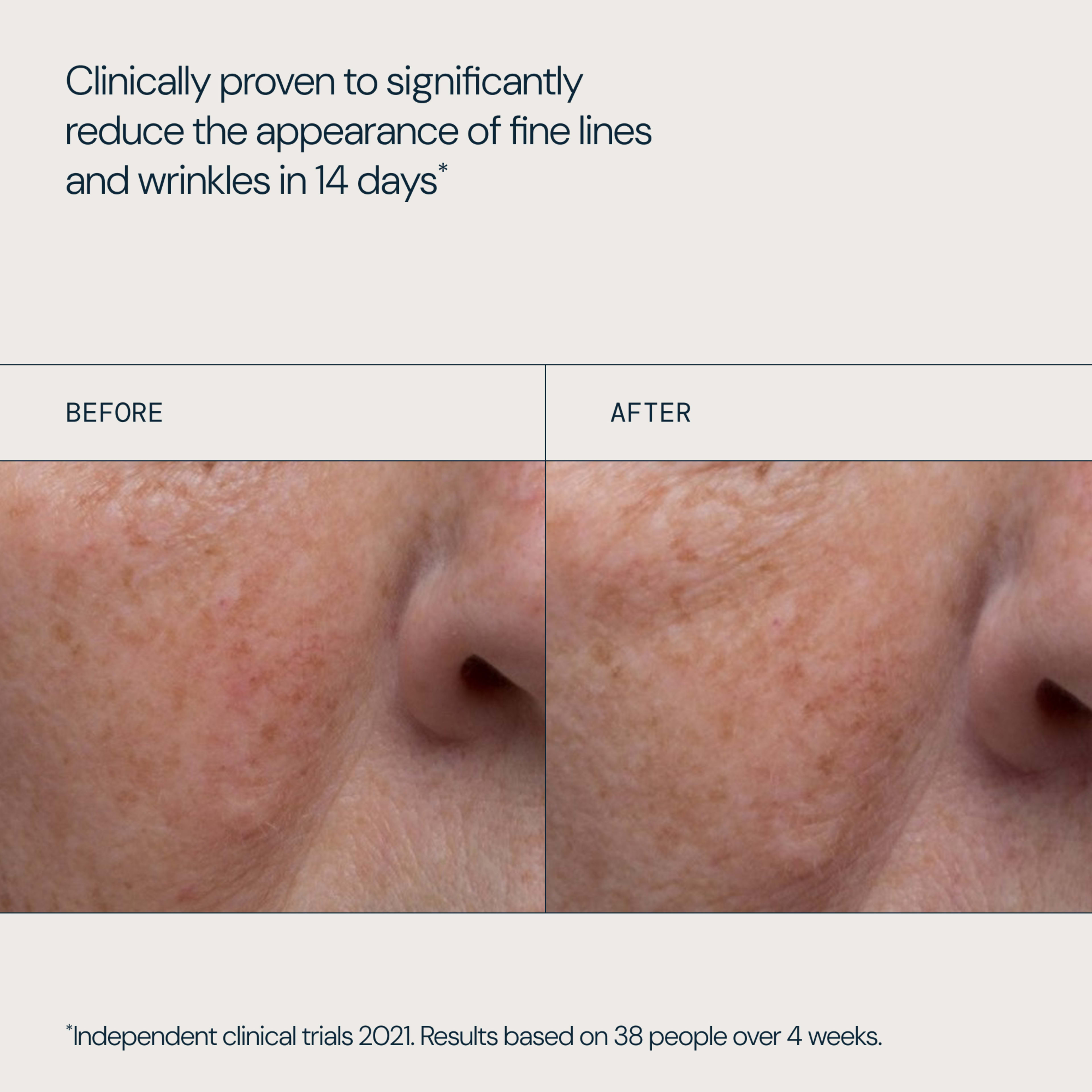 Clinically proven to significantly reduce the appearance of fine lines and wrinkles in 14 days. Split-screen close-up of skin beside a nose labelled before and after, showing visibly smoother, less lined texture after using the ELEMIS product.