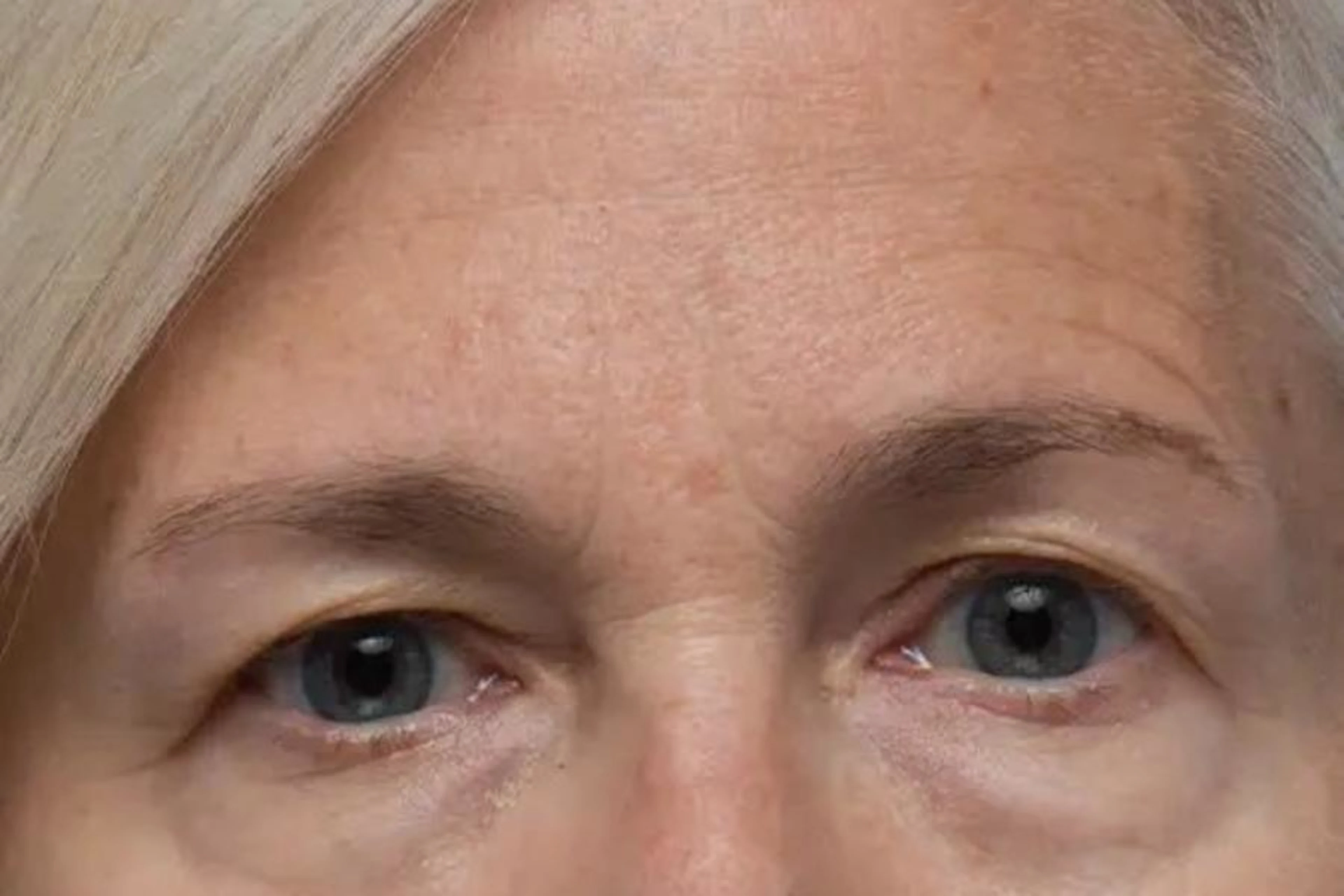 What Is Mature Skin?